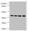 Family With Sequence Similarity 110 Member B antibody, A53567-100, Epigentek, Western Blot image 