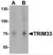 Tripartite Motif Containing 33 antibody, NBP2-81762, Novus Biologicals, Western Blot image 