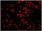 Protein Phosphatase 4 Regulatory Subunit 3A antibody, NB100-2879, Novus Biologicals, Immunofluorescence image 