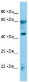 Adh-3 antibody, TA346215, Origene, Western Blot image 