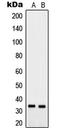 Prostaglandin Reductase 2 antibody, LS-C353641, Lifespan Biosciences, Western Blot image 