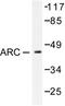 Nucleolar Protein 3 antibody, LS-C175923, Lifespan Biosciences, Western Blot image 