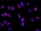 SRY-Box 11 antibody, GTX02416, GeneTex, Immunofluorescence image 