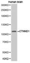 Catenin Delta 1 antibody, LS-C192742, Lifespan Biosciences, Western Blot image 