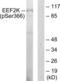 Eukaryotic Elongation Factor 2 Kinase antibody, LS-C198900, Lifespan Biosciences, Western Blot image 