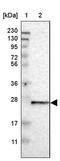 Transmembrane P24 Trafficking Protein 9 antibody, PA5-53203, Invitrogen Antibodies, Western Blot image 