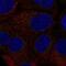 Colony Stimulating Factor 2 antibody, NBP2-56096, Novus Biologicals, Immunocytochemistry image 