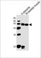 Delta Like Non-Canonical Notch Ligand 1 antibody, A00513-3, Boster Biological Technology, Western Blot image 
