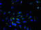SRP Receptor Subunit Beta antibody, LS-C372354, Lifespan Biosciences, Immunofluorescence image 