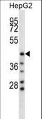 Hyaluronidase 1 antibody, LS-C165092, Lifespan Biosciences, Western Blot image 