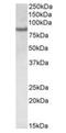 CREB Regulated Transcription Coactivator 2 antibody, orb22525, Biorbyt, Western Blot image 