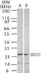 Suppressor Of Cytokine Signaling 1 antibody, NB100-56637, Novus Biologicals, Western Blot image 