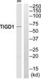 Tigger Transposable Element Derived 1 antibody, TA312580, Origene, Western Blot image 