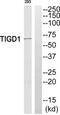 Tigger Transposable Element Derived 1 antibody, TA312580, Origene, Western Blot image 