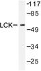 LCK Proto-Oncogene, Src Family Tyrosine Kinase antibody, LS-C176423, Lifespan Biosciences, Western Blot image 