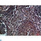 CD70 Molecule antibody, LS-C813817, Lifespan Biosciences, Immunohistochemistry paraffin image 