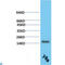 Transthyretin antibody, LS-C813244, Lifespan Biosciences, Western Blot image 