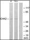 Checkpoint Kinase 2 antibody, orb95965, Biorbyt, Western Blot image 