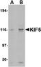 Kinesin Family Member 5A antibody, NBP1-76816, Novus Biologicals, Western Blot image 
