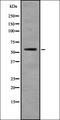 Keratin 6A antibody, orb336837, Biorbyt, Western Blot image 