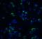 Mitogen-Activated Protein Kinase Kinase Kinase 14 antibody, 1129, ProSci, Immunofluorescence image 