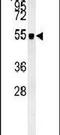 Zinc finger protein ZIC 3 antibody, PA5-24604, Invitrogen Antibodies, Western Blot image 