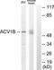 Activin A Receptor Type 1B antibody, TA312143, Origene, Western Blot image 