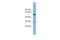 Transmembrane 4 L Six Family Member 20 antibody, A14375, Boster Biological Technology, Western Blot image 