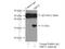 Sirtuin 5 antibody, 15122-1-AP, Proteintech Group, Immunoprecipitation image 