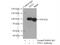 TPX2 Microtubule Nucleation Factor antibody, 11741-1-AP, Proteintech Group, Immunoprecipitation image 