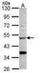 Chitinase 1 antibody, LS-C185418, Lifespan Biosciences, Western Blot image 