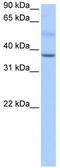 SERTA Domain Containing 2 antibody, TA339234, Origene, Western Blot image 