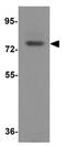 Growth Arrest Specific 6 antibody, GTX31628, GeneTex, Western Blot image 