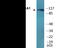 ATPase Na+/K+ Transporting Subunit Alpha 1 antibody, EKC2314, Boster Biological Technology, Western Blot image 