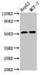 Angiotensinogen antibody, CSB-PA10079A0Rb, Cusabio, Western Blot image 