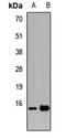 Trafficking Protein Particle Complex 2 antibody, LS-C668495, Lifespan Biosciences, Western Blot image 