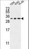 Tetraspanin 2 antibody, LS-C160263, Lifespan Biosciences, Western Blot image 