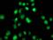 Pantothenate kinase 1 antibody, orb69831, Biorbyt, Immunofluorescence image 