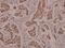 Peroxisome Proliferator Activated Receptor Gamma antibody, PA5-36763, Invitrogen Antibodies, Immunohistochemistry frozen image 