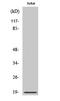 Stathmin 1 antibody, A01194S25, Boster Biological Technology, Western Blot image 