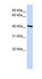 Tropomodulin 3 antibody, orb325958, Biorbyt, Western Blot image 