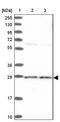 Amidohydrolase Domain Containing 2 antibody, NBP1-84516, Novus Biologicals, Western Blot image 