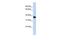 Nudix Hydrolase 18 antibody, GTX46166, GeneTex, Western Blot image 