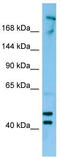 Serine/threonine-protein kinase MRCK beta antibody, TA338137, Origene, Western Blot image 