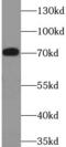 Follicle-stimulating hormone receptor antibody, FNab03231, FineTest, Western Blot image 