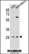 Interleukin 12B antibody, 55-192, ProSci, Western Blot image 