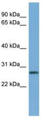 Cyclin-D1-binding protein 1 antibody, TA333575, Origene, Western Blot image 