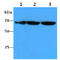 Far Upstream Element Binding Protein 1 antibody, GTX57628, GeneTex, Western Blot image 
