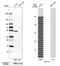 Keratin 15 antibody, NBP1-85603, Novus Biologicals, Western Blot image 