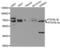 Autophagy Related 16 Like 1 antibody, STJ22707, St John